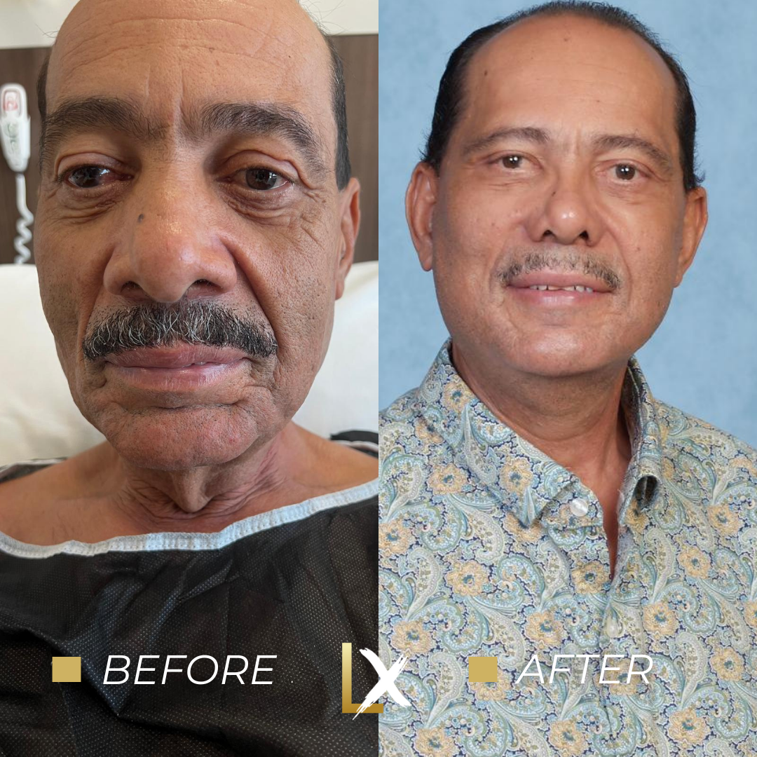 Rafael Dantes Castillo