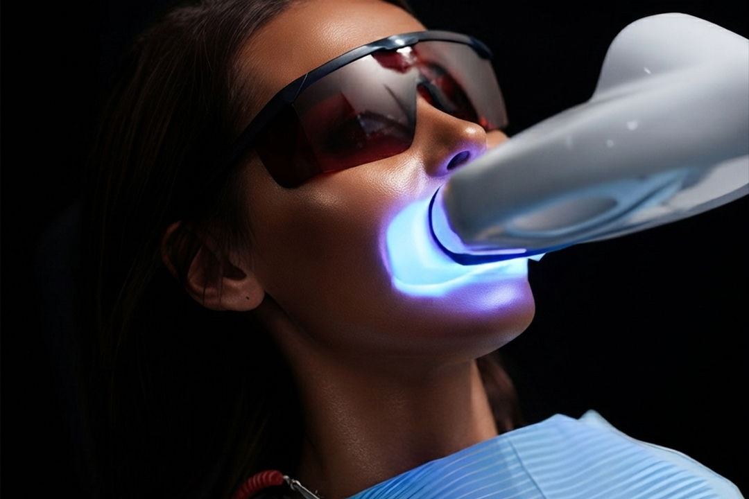 Teeth Whitening